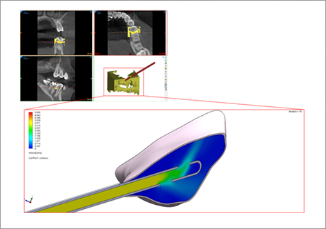 FEA analysis of glass