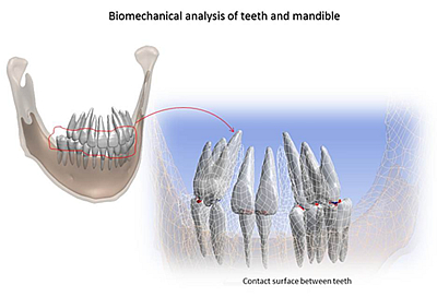 Mandible and teeth