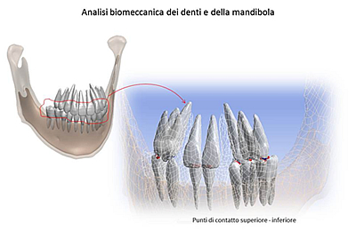 Assieme 3D della mandibola e della dentatura