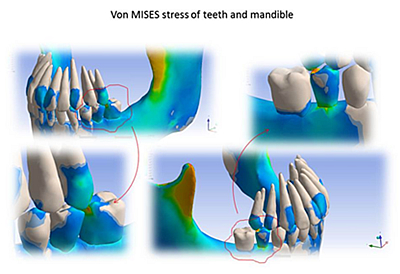 von MISES stress