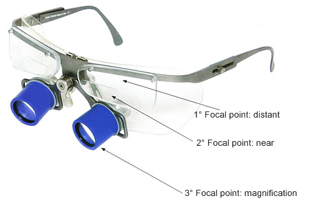 Elspace Trifocal System